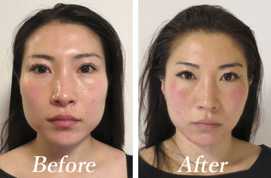 サエコ様　30代　主婦