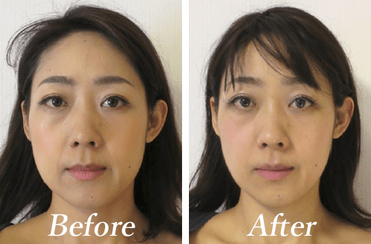 Yokko様　40代　ヨガインストラクター