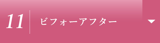 【11】ビフォーアフター