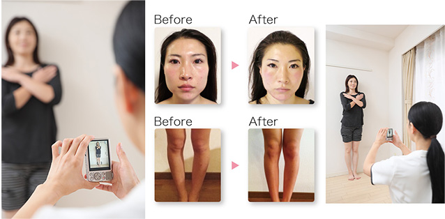 ビフォーアフター